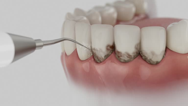 Reliable Dental contractor in Petersburg, IN by Dentist Open Now